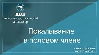 861  Покалывание в половом члене