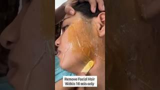 Remove Fical Hair Within 10 Min Only|How To Remove Fical Hair Permanently #trending #skincare #yt