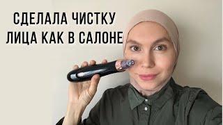 Как очистить поры и избавиться от черных точек. Вакуумная чистка лица