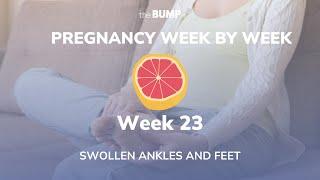 Pregnancy Week 23 | Swollen Ankles and Feet | Pregnancy Week By Week