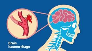 What is a head injury?