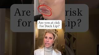 Are you at Risk for Duck Lips? #botox #beauty #filler #lips