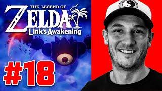 Final Boss, Wind Fish's Egg, Magnifying Lens | Legend of Zelda: Link's Awakening | Part 18