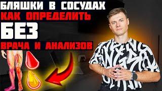 Бляшки в сосудах? Как определить без врача и анализов!