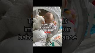 The UNTOLD impact on your baby’s appearance #newmom #newborncare #newborn #newmomtips #babycare