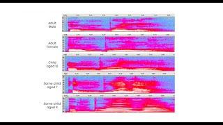 How Children's Voices Change With Age - Voice AI Demo