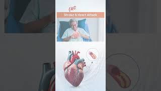 "Natural bypass, no cuts, no downtime – only at Oplus EECP Rajkot #eecp #heartattack #heartblockage