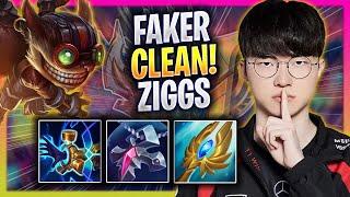 FAKER IS SUPER CLEAN WITH ZIGGS MID! - T1 Faker Plays Ziggs MID vs Gragas! | Season 2024