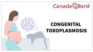 Congenital Toxoplasmosis