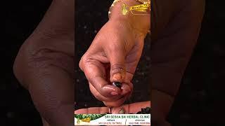 தலைமுடி பலபலக்க கறிவேப்பிலை பழம் /karivepilai fruit for hair