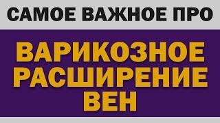 Варикозное расширение вен: Самое важное (Причины, операция, гели, бельё, упражнения)