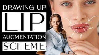 Drawing up A LIP AUGMENTATION SCHEME