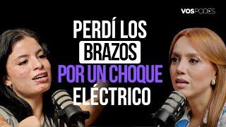 PERDÍ LOS BRAZOS POR UN CHOQUE ELÉCTRICO  (CON: KAROL BASTIDAS) |Vos podés - EP 162|