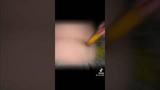 Pulling my belly button out