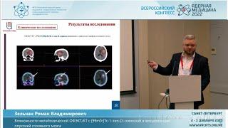 Возможности метаболической ОФЭКТ/КТ с Тиоскан, 99mTc  в визуализации опухолей головного мозга