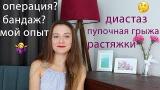 Восстановление фигуры после родов, диастаз, пупочная грыжа и растяжки. Мой опыт