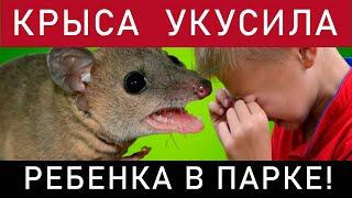 Крыса укусила ребенка в парке!