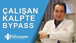 Çalışan Kalpte Bypass | Kalp ve Damar Cerrahisi - Prof. Dr. Yavuz Beşoğul