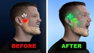 The Revolutionary New Fix For TMJ & Jaw Pain