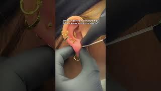 Stacked lobe piercing with titanium gold jewelry 