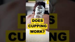 Unbelievable Cupping Hacks That Will Transform Your Practice! #CuppingTherapy #Hijama #tcmsecrets