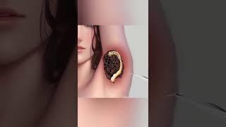 underarm deep cleaning #asmr #satisfyingvideo #armpits #asmranimation