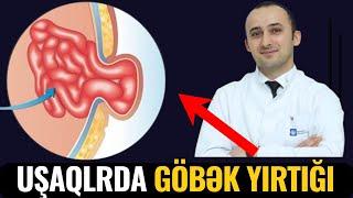 Qətiyyən Əl Vurmayın! - Uşaqlarda göbək yırtığı