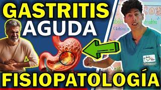 GASTRITIS FISIOPATOLOGÍA | GuiaMed