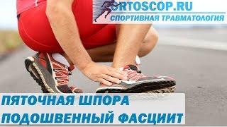 ПЯТОЧНАЯ ШПОРА. ПОДОШВЕННЫЙ ФАСЦИИТ