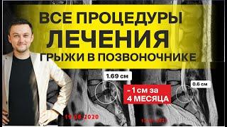 Вся правда о лечении в Клинике Ткачева Епифанова (КТЕ, ТЕМЕД). 2 курса резорбции - какие итоги?