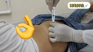 intramuscular IM shot an injection into the gluteal muscle