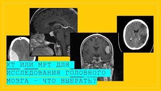 КТ или МРТ для исследования головного мозга - что выбрать? Разница между КТ и МРТ