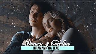 damon&caroline × шрамами на теле [Daroline]