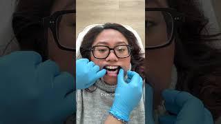 Expectation vs Reality - teeth whitening edition  #teethwhitening #torontoteethwhitening