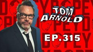 Dopey 315: Tom Arnold