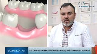 Diş tedavilerinde kullanılan kemik materyallerinin çeşitleri nelerdir