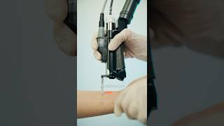 Laser hair removal made easy with Cynsoure  #smoothskin#shortsfeed
