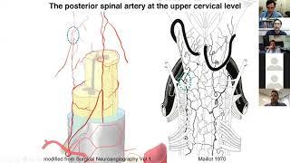 2020 10 06 BANANAZ Craniocervical Junction and Virtual Embo Club