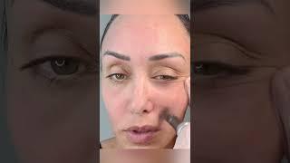 Get that tight , young , clear skin!   #microneedling #skincare #beauty #skin