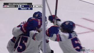 2024 HC U17 World Challenge - USA vs Finland