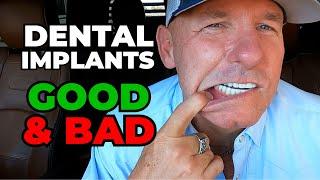 The GOOD and BAD Of My Dental Implants After 2 Years