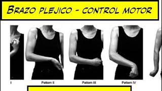 Control motor - brazo plejico - Terapia ocupacional