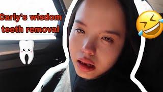 Wisdom Teeth Removal | NGAKAK BGT 