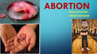 Abortion  | Abortion- obstetrics | Short Notes full details #mbbs #bams #surgery #abortion