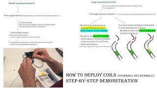 Coronary perforation