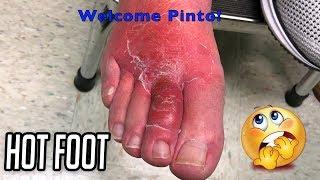Hot Foot Pinto?  Dr. Gilmore Strikes Again