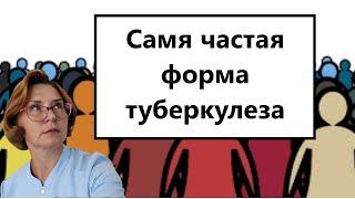 Инфильтративный туберкулез