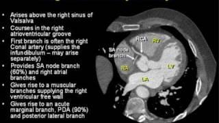 Coronary Arterial Anatomy