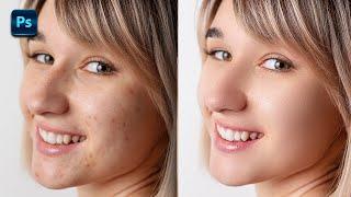 Retouch Skin in Seconds! | Photoshop Tutorial | Skin Retouching