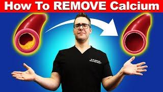 How To REMOVE Calcium From Your Arteries? [Top 15 Vitamin K2 Foods]